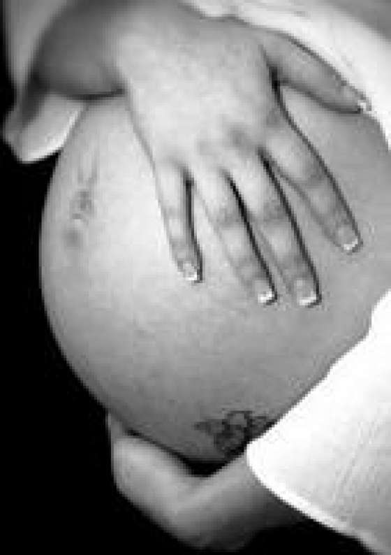 Capacitan a equipos de salud en la implementación del Paquete Perinatal de Alta complejidad