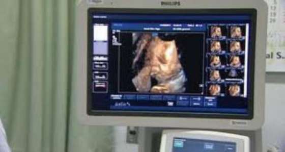 El Hospital de Embarcación cuenta con un ecógrafo portátil