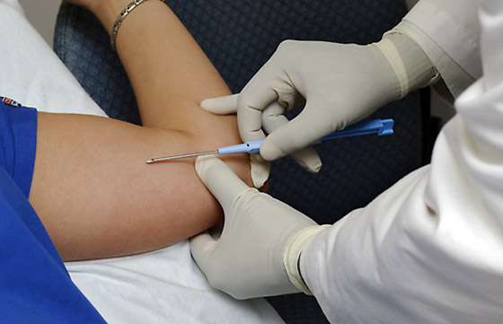 Continúa la colocación del implante subdérmico anticonceptivo a adolescentes de 15 a 19 años