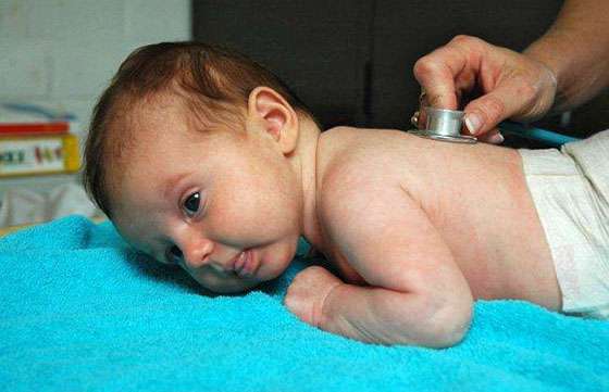 Salud Pública recomienda extremar los cuidados en lactantes por bronquiolitis