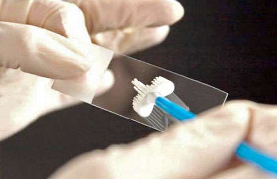 Papanicolau sin turnos previos en el Hospital San Bernardo