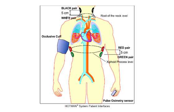 Novedosa investigación para el tratamiento de la hipertensión arterial