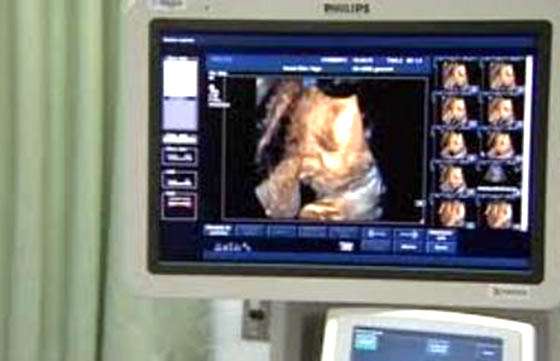 El hospital de San Antonio de los Cobres contará con un ecógrafo