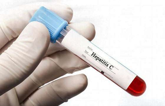 Hasta el viernes se realizan testeos rápidos para detectar Hepatitis C