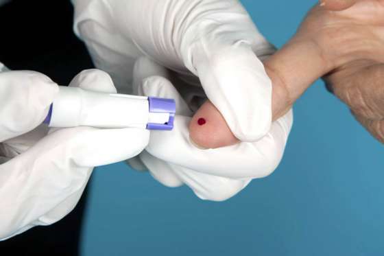 Promueven el test de VIH como estrategia para frenar el avance de la epidemia