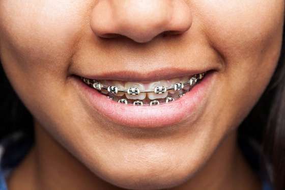 En diez centros de salud de la capital se brinda el servicio de Ortodoncia