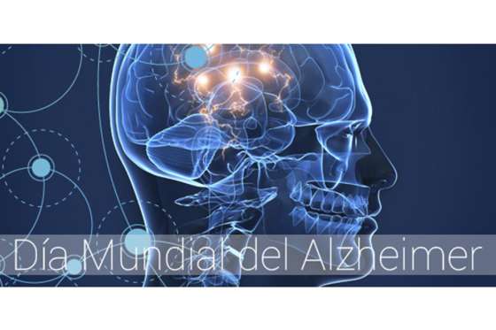 Arte para reflexionar en el Día Mundial de la Enfermedad de Alzheimer