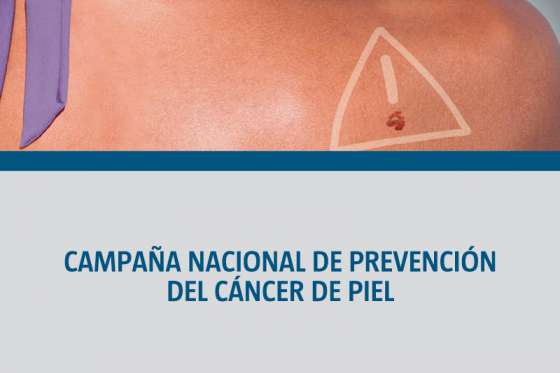 Campaña de prevención del cáncer de piel en el hospital San Bernardo