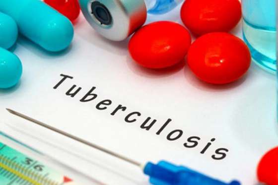 Profesionales de Salud Pública expondrán hoy sobre tuberculosis en la Universidad Católica de Salta