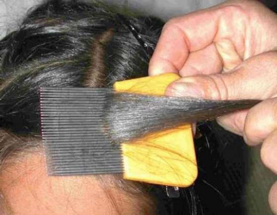 Recomendaciones para evitar la pediculosis