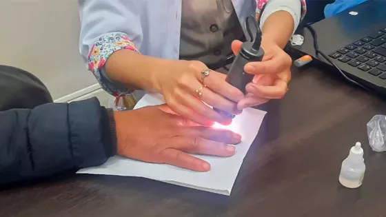 El hospital Señor del Milagro realizará una charla abierta sobre la esclerodermia