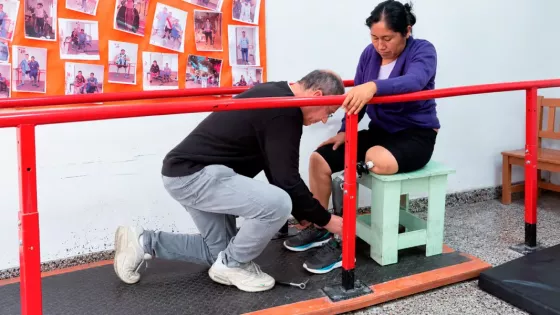 Avanza la rehabilitación de una paciente con prótesis osteointegrada en el CePReFis