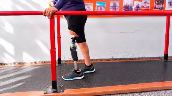 Avanza la rehabilitación de una paciente con prótesis osteointegrada en el CePReFis