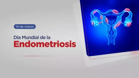 El diagnóstico temprano es clave para el tratamiento de la endometriosis