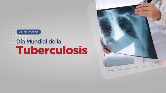 Salud intensifica las acciones de prevención y control en el marco del Día Mundial de la Tuberculosis