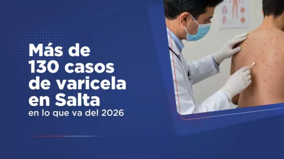 Suman más de 130 los casos de varicela en Salta