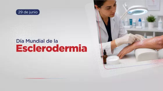 La esclerodermia es una afección reumática que afecta mayormente a las mujeres