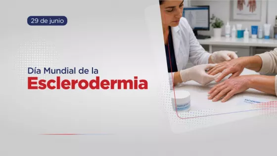 La esclerodermia es una afección reumática que afecta mayormente a las mujeres