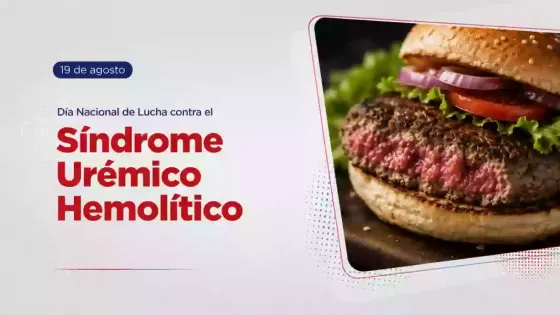El síndrome urémico hemolítico se puede prevenir cuidando la preparación de alimentos