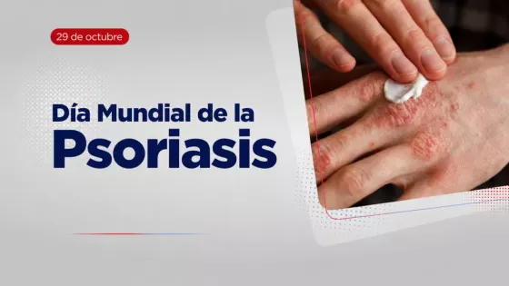 Con tratamiento médico es posible reducir síntomas y brotes de psoriasis