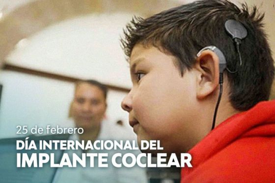 El implante coclear es una alternativa de solución para la hipoacusia profunda