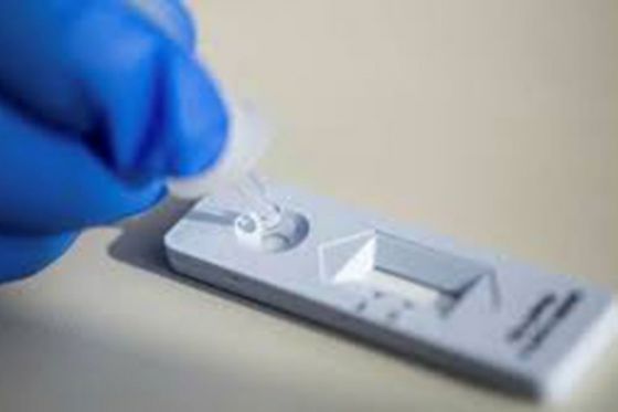 Se realizan test de coronavirus y de influenza en el Centro COVID-19 Salta