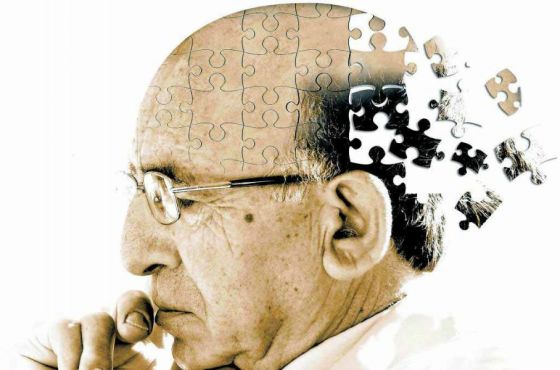 La principal manifestación del Alzheimer es el trastorno de la memoria