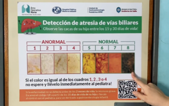 Se realizará una capacitación sobre atresia de vías biliares